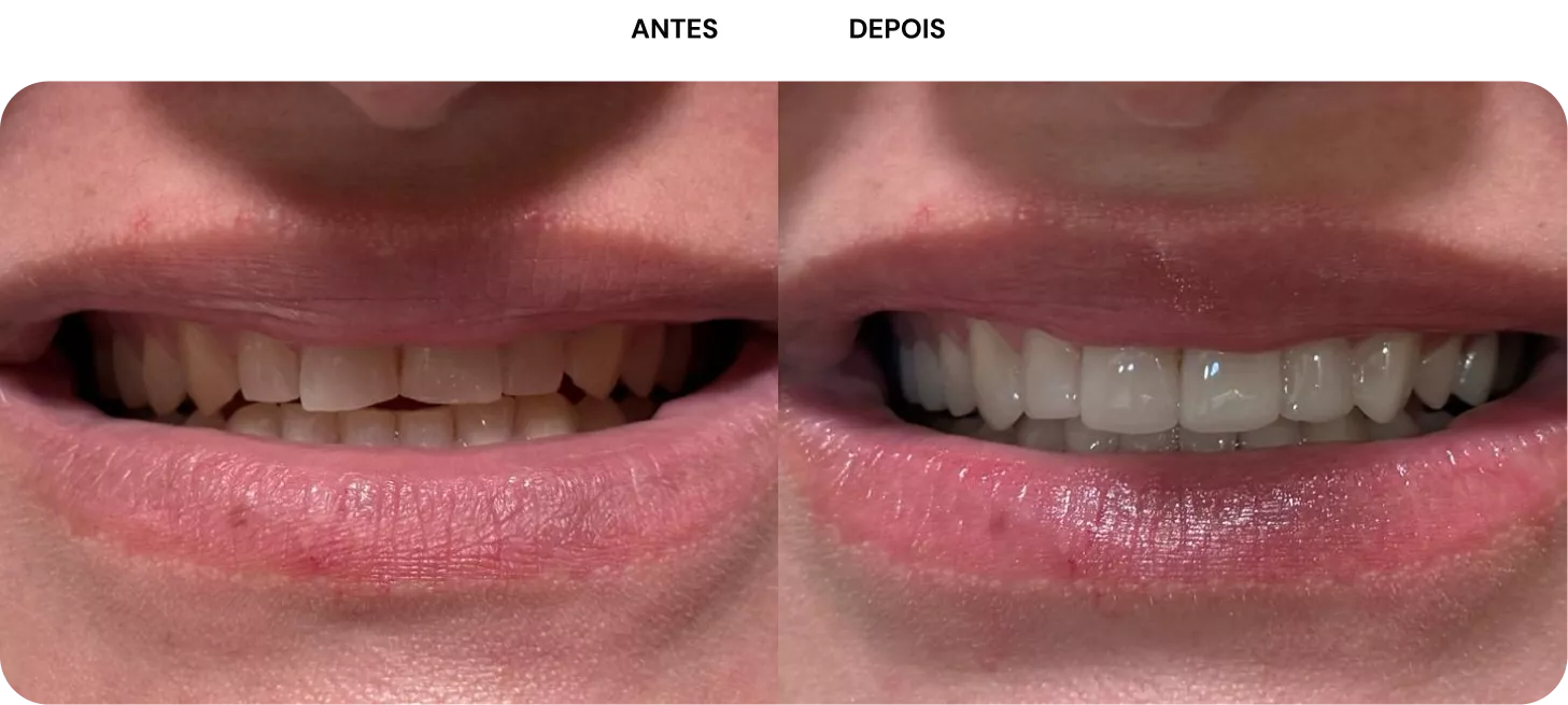 1-antes-e-depois-692ed9d77254a