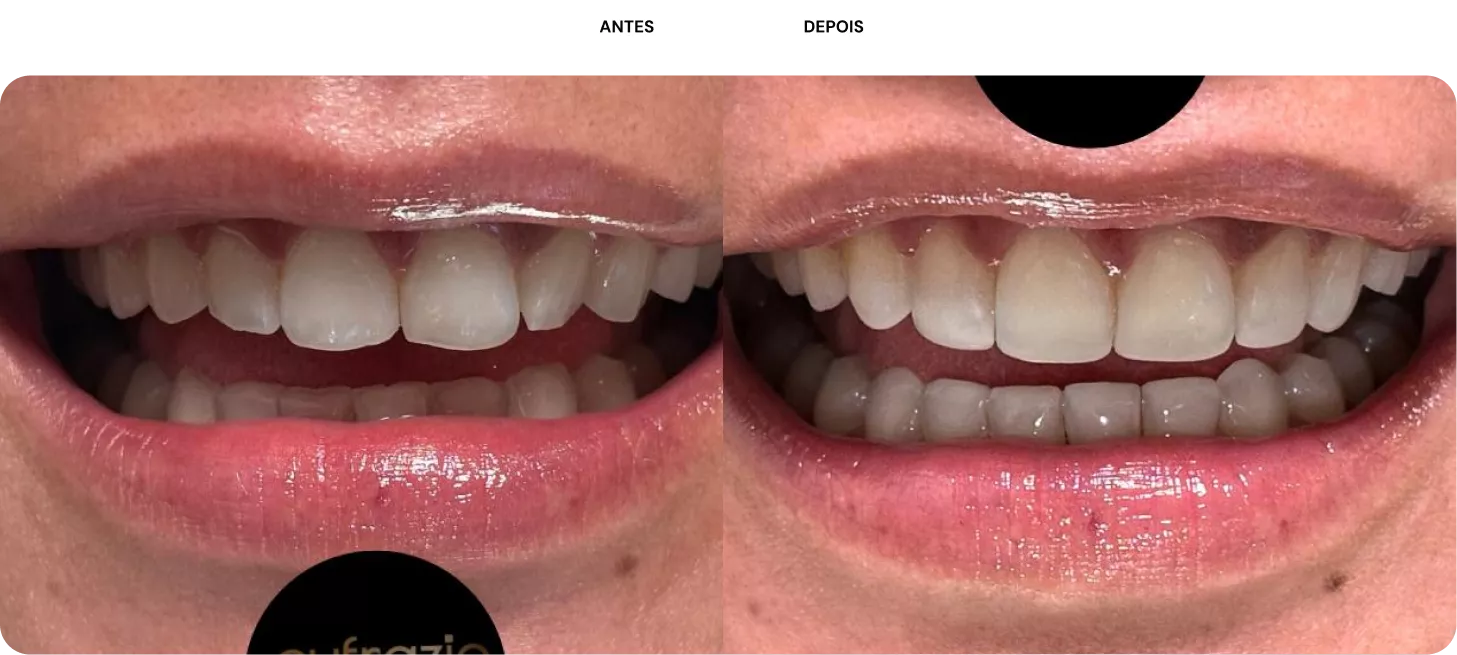 2-antes-e-depois-692ed9d772e0a