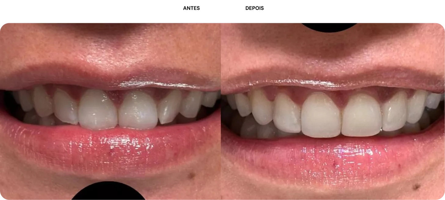 3-antes-e-depois-692ed9d85aae1