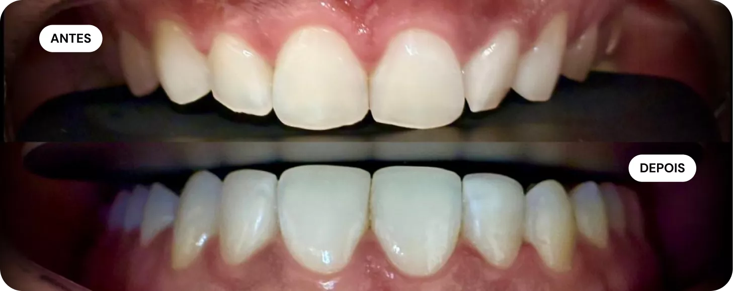 4-antes-e-depois1-692eda989df8c